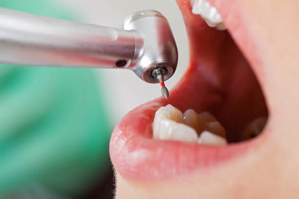 Best Emergency Dental Care for Trauma or Injury in Sea Isle City, NJ